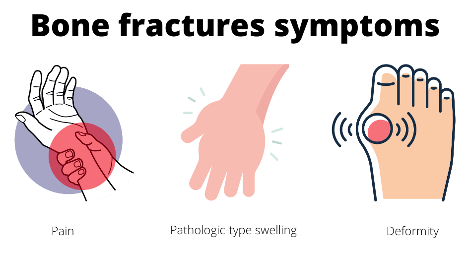 bone-fractures-symptoms