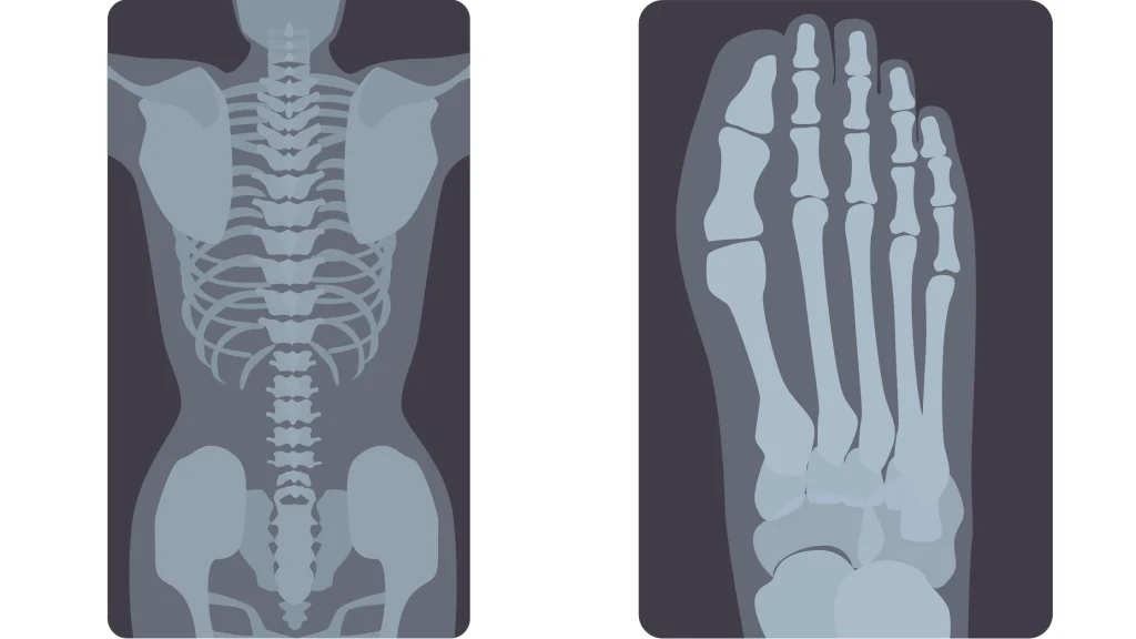 grafiche-di-radiografie-della-colonna-vertebrale-e-del-piede-destro
