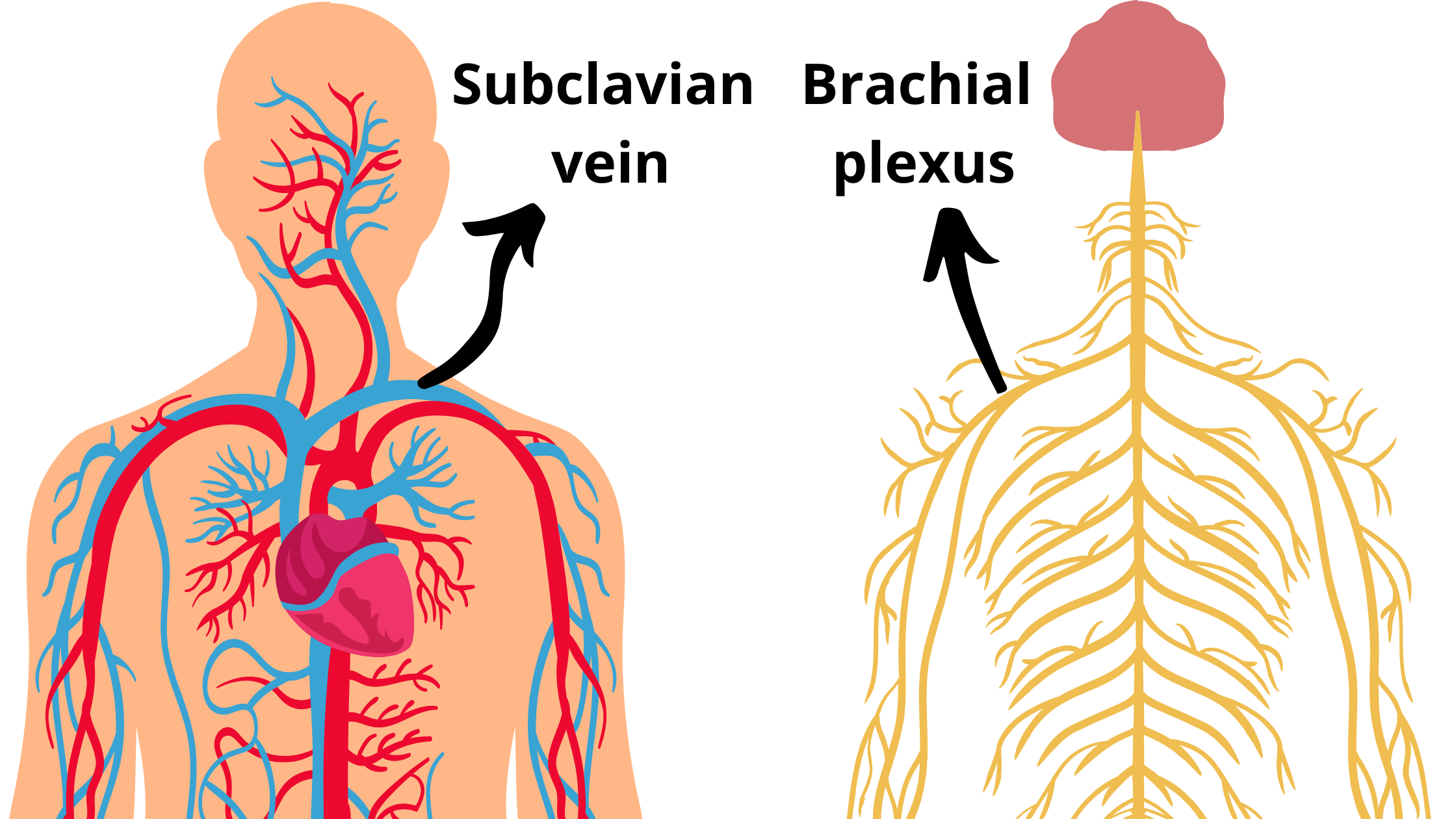 Anatomy-of-the-subclavian-vein-and-brachial-plexus-in-clavicle-fractures