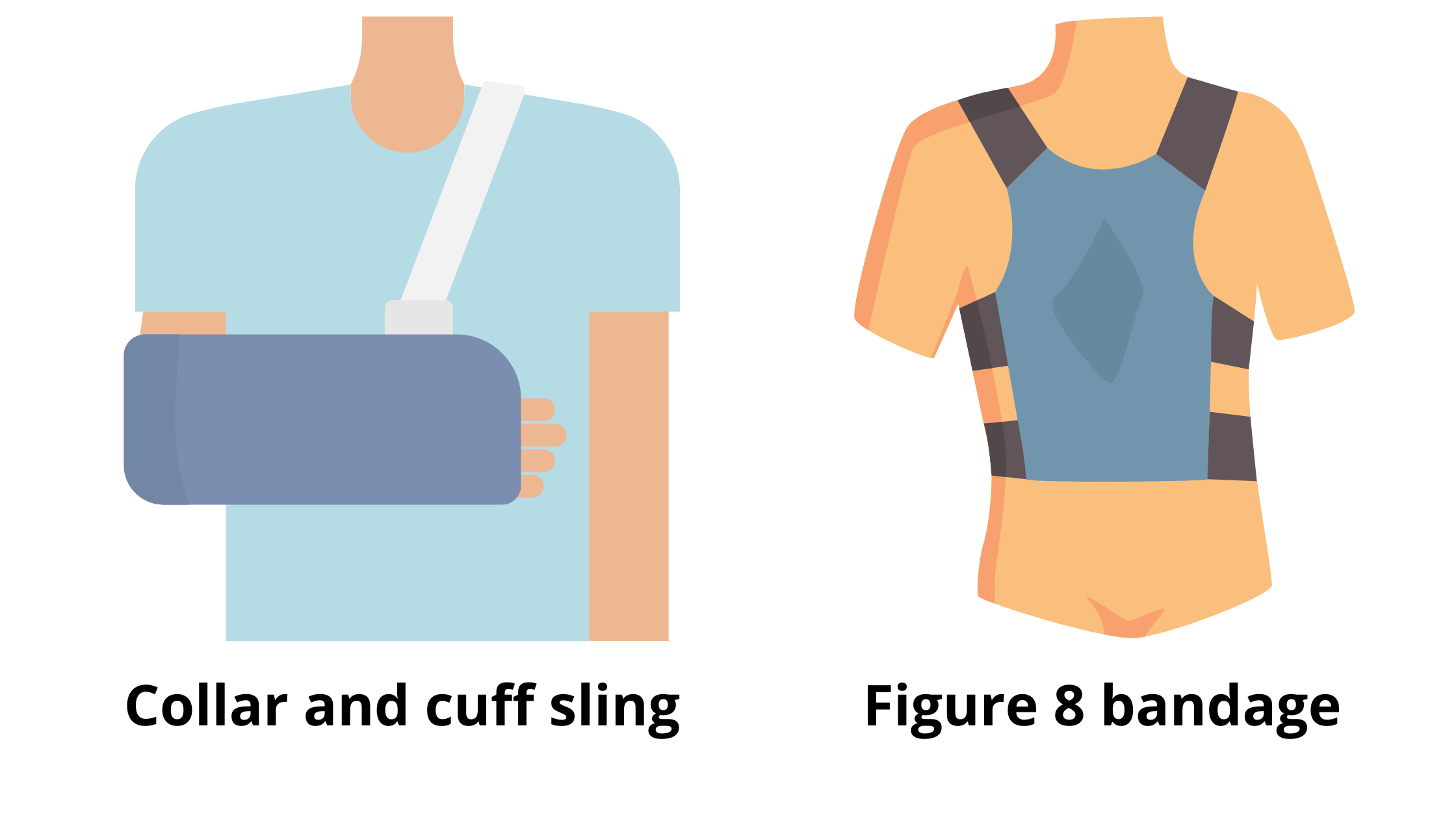 cuff-and-collar-harness-and-figure-of-eight-bandage-are-the-mostly-adopted-conservative-therapies