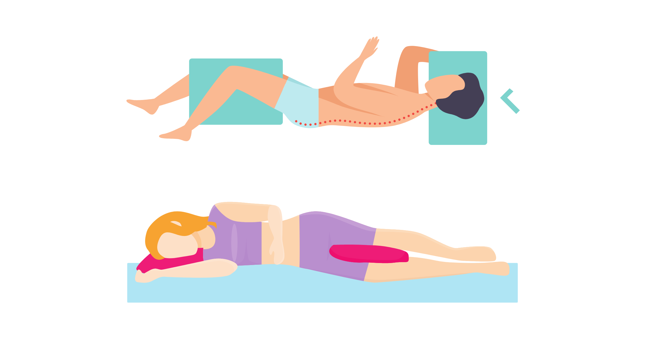 La posizione fetale e laterale con un cuscino in mezzo alle gambe, tra le ginocchia per allineare la colonna lombare nelle sindromi di spondilolistesi vertebrale