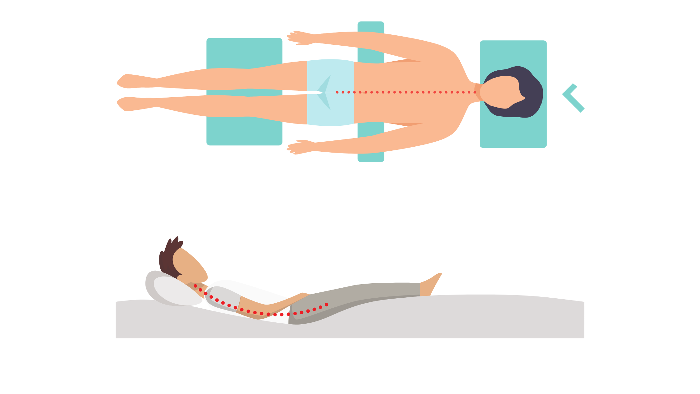 grafiche di posizioni per dormire con la sindrome da spondilolistesi vertebrale a pancia in su con supporti sotto le ginocchia e su materasso molle