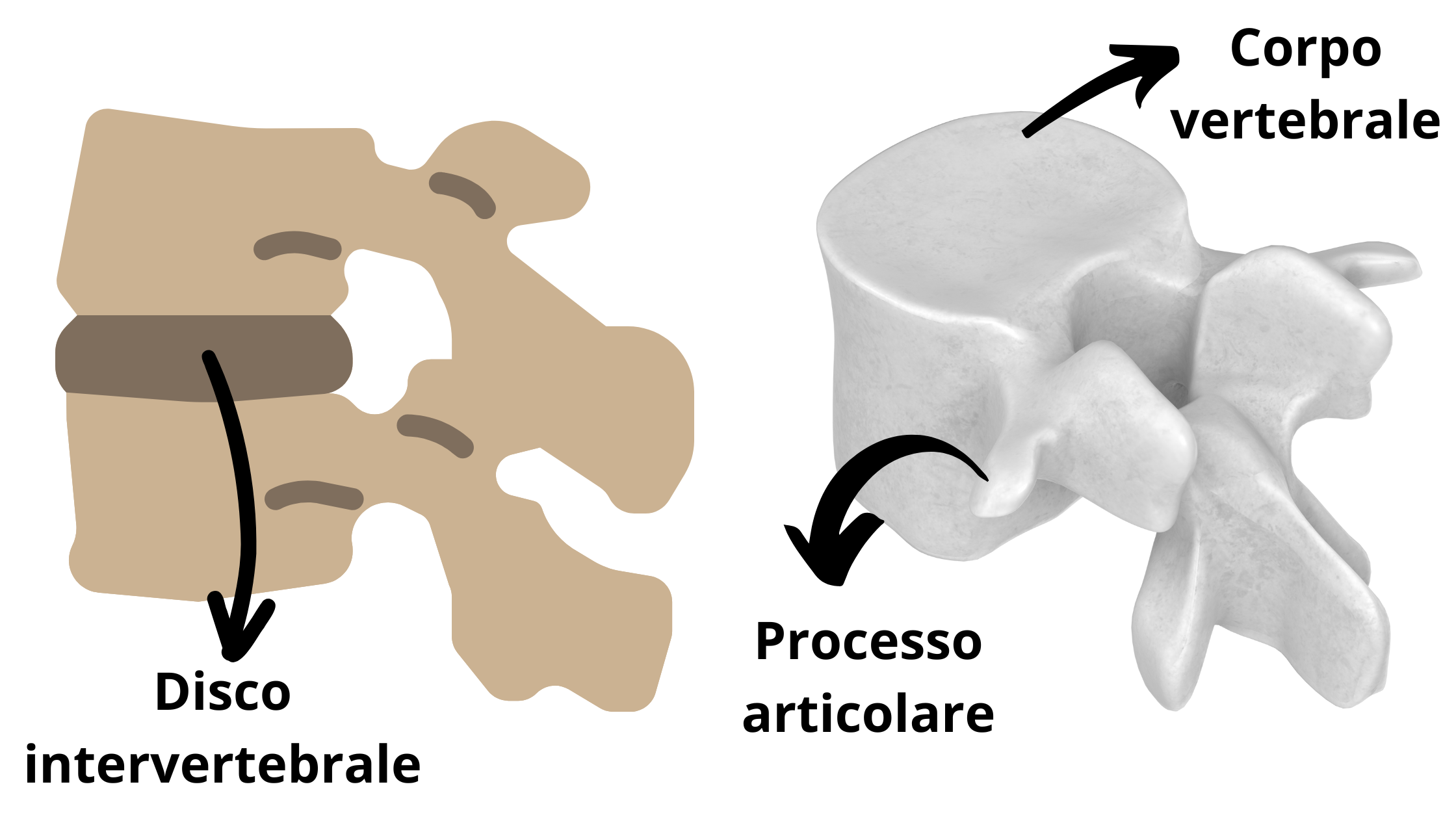 la vertebra lombare e la distinzione delle strutture presenti, quali il disco intervertebrale, il corpo e il processo articolare