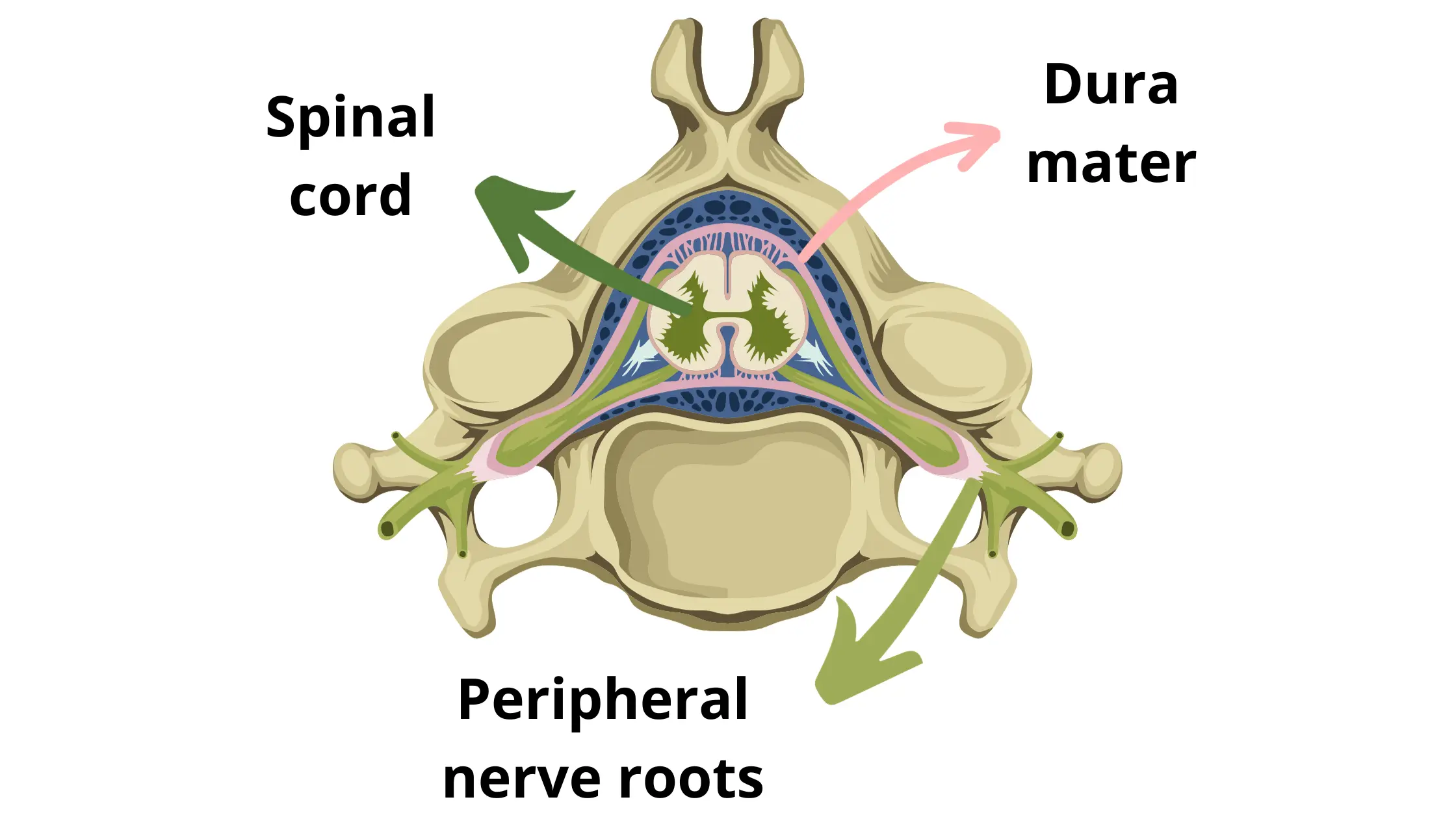 representation of a cervical vertebra, with spinal cord, dura mater and peripheral nerve roots