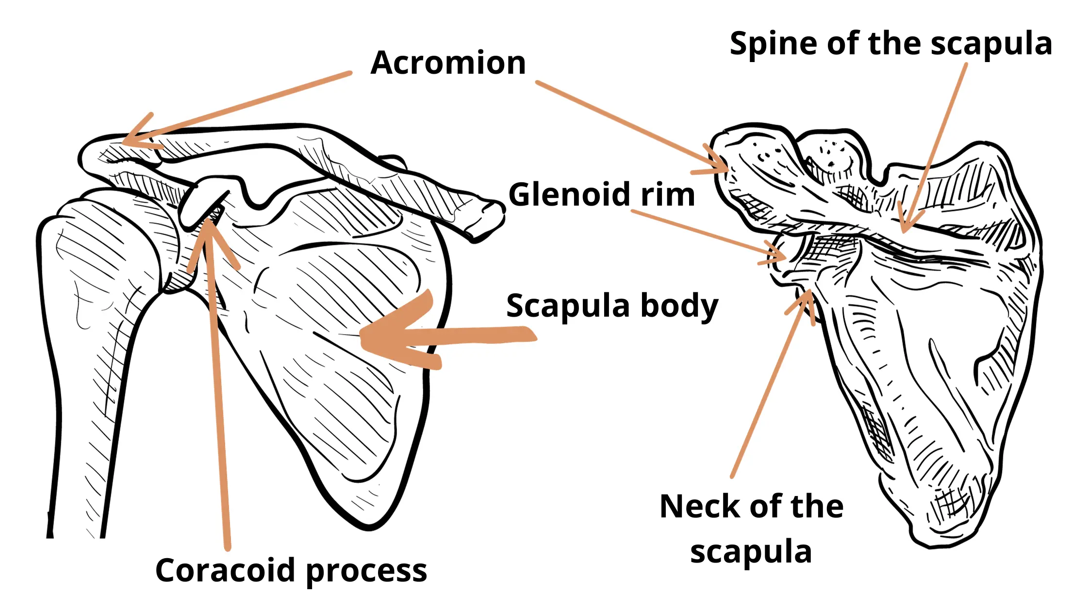 Most common locations where scapula fractures occur such as the acromion glenoid rim, spine of the scapula, scapula body, coracoid process and scapula neck