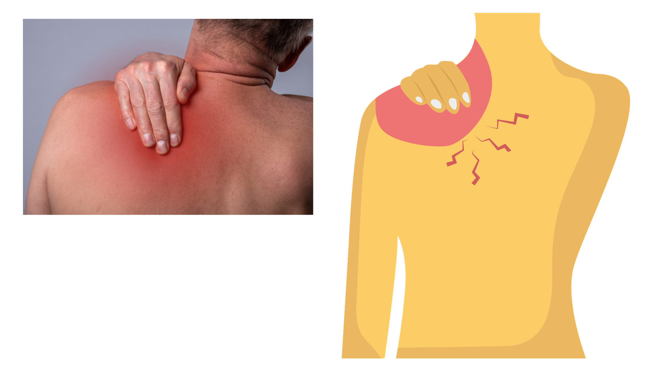 common attitude for those suffering from neck pain is to place a hand on the painful area